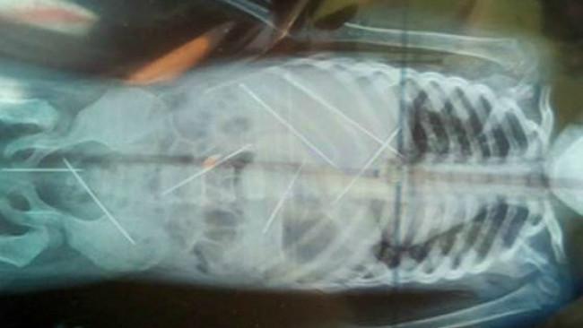 Di dalam tubuh balita perempuan itu terdapat 7 jarum yang dimasukkan secara paksa ke dalam tubuh mungil korban. (Sumber Manogya Loiwal)