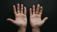 Apa Itu Simian Line? Garis Lurus di Telapak Tangan yang Langka