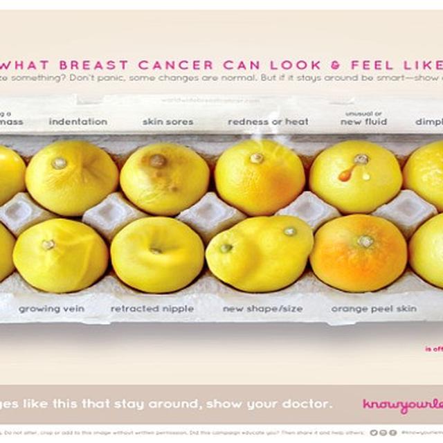 Penggunaan Lemon Dinilai Mampu Deteksi Gejala Kanker Payudara Health Liputan6 Com