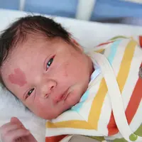Lucu bangeeet! Bayi asal Turki ini punya tanda lahir unik bentuk love di keningnya. (Via: boredpanda.com)