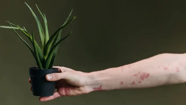 aloe 5