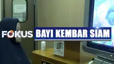Setelah enam hari menjalani perawatan intensif di Ruang ICU, Akila sudah dipindah ke ruang rawat inap. Namun Azila masih harus berada di ICU karena baru selesai jalani operasi rekonstruksi.