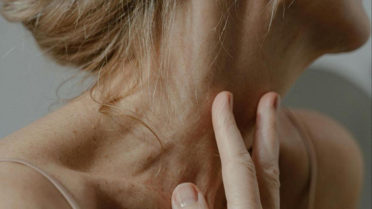 Cara Mengatasi Herpes di Leher