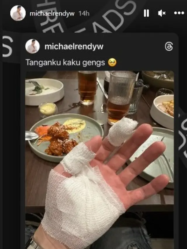 Potret Kronologi Perampokan di Rumah Selebgram Michael Rendy, Pelaku Tetangga