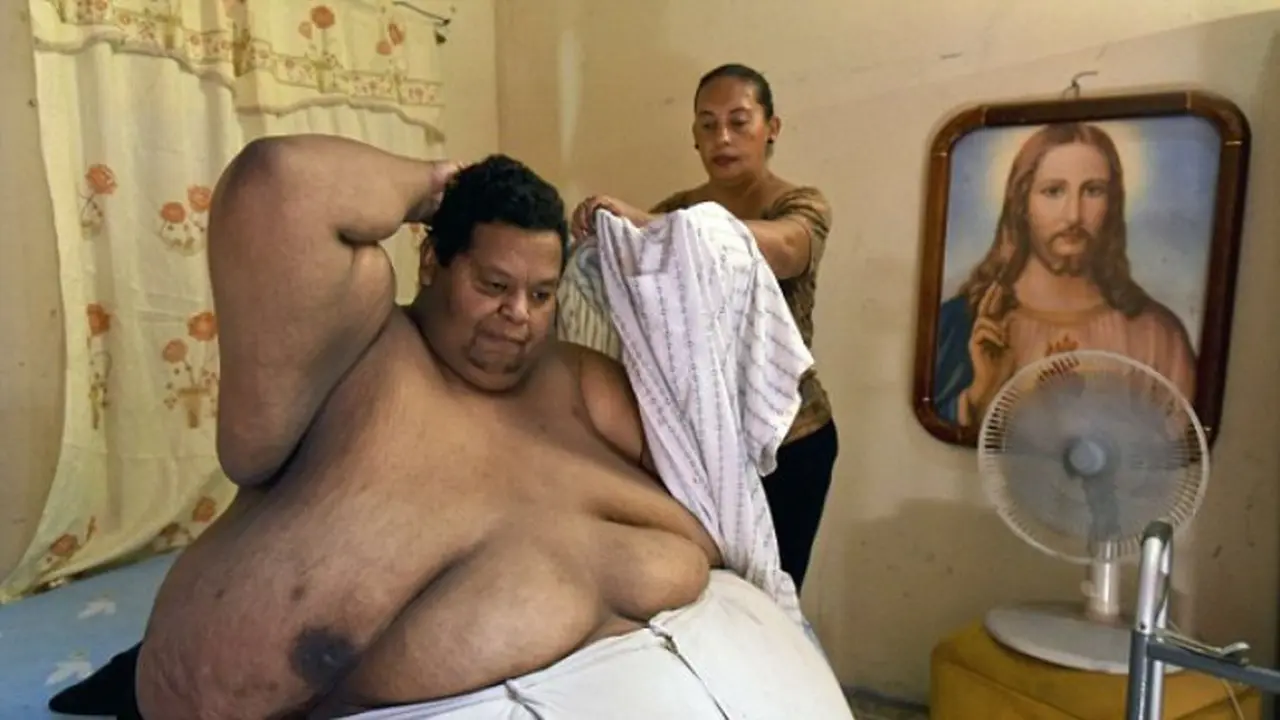 Berbobot 400 Kg, Pria Ini Butuh Pemadam Kebakaran Agar Bisa Hidup