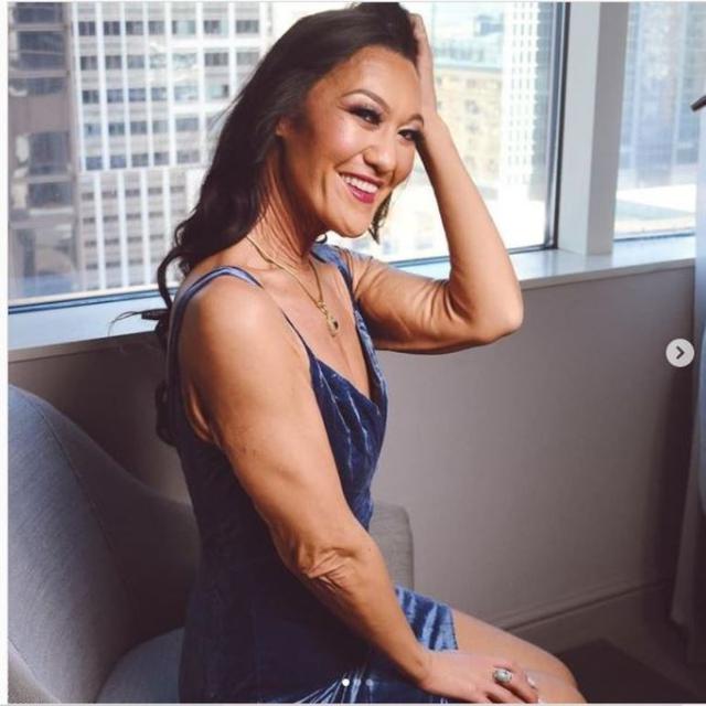 Cerita Wanita yang Kulitnya Sudah Keriput di Usia 20an Tapi Jadi Model