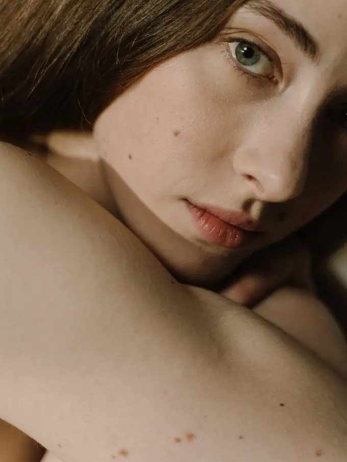 Ilustrasi Tahi Lalat