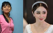Deretan Artis Lakukan Tanam Benang, Ini Foto Before-Afternya