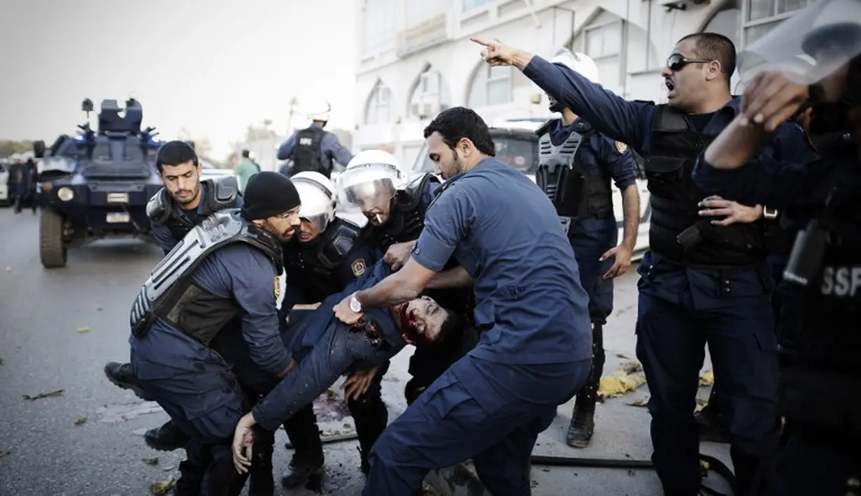 Seorang polisi terluka dalam bentrok yang terjadi di pinggiran ibukota Manama pada hari Senin (3/3/14) Bahkan dikabarkan ada 3 polisi tewas dalam aksi itu (AFP PHOTO/Mohammed Al-Shaik).