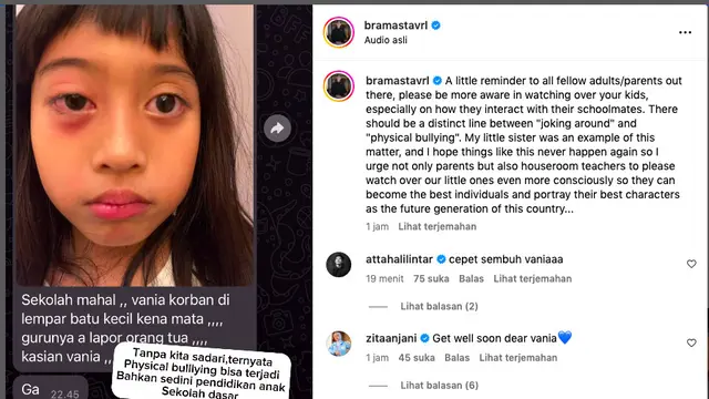 Verrell Bramasta Kaget Adiknya Jadi Korban Kekerasan dari Teman SD, Beri Pesan untuk Orang Tua Agar Lebih Mengawasi Anak-Anak