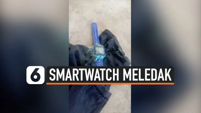 VIDEO: Detik-Detik Smartwatch Anak Meledak dan Keluarkan Asap