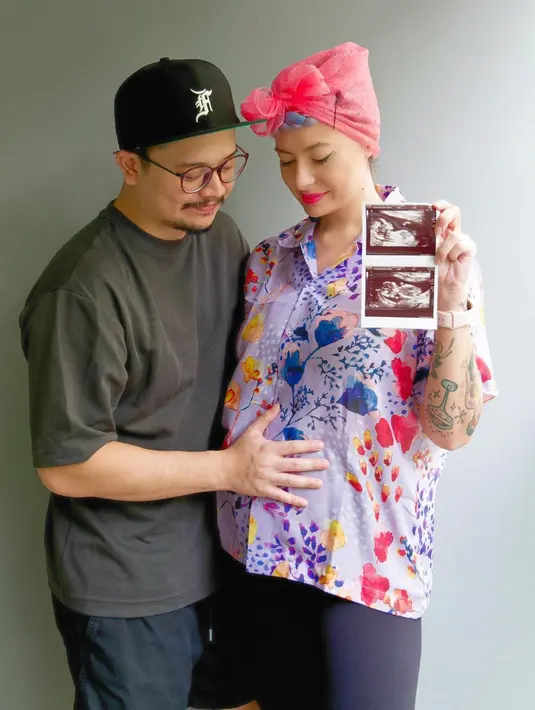 Derby Romero dan Claudia Adinda (Instagram/miss_adinda_mae)