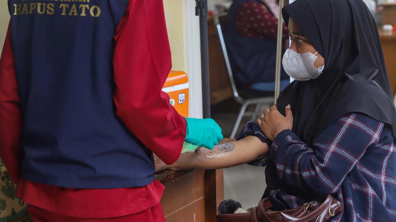 FOTO: Layanan Hapus Tato Gratis Sambut Ramadhan di Jakarta