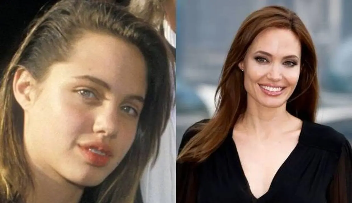 Bahkan aktris secantik Angelina Jolie pun pernah memakai kawat gigi. (dailymix.info)