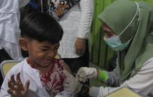Kasus KLB Campak di 3 Kabupaten, Dinkes Jateng Sisir Anak yang Belum di Imunisasi