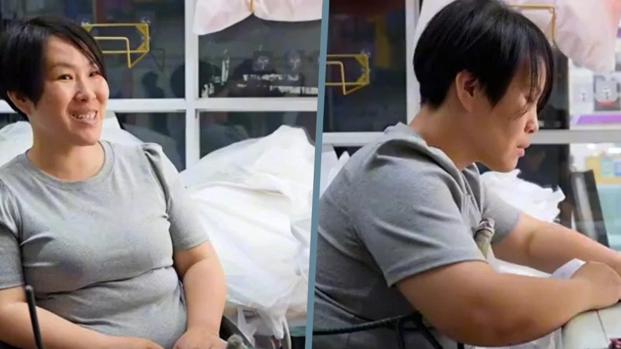 Keunikan dari Keterbatasan, Perempuan Ini Bisa Menjahit Pakai Otot Perut