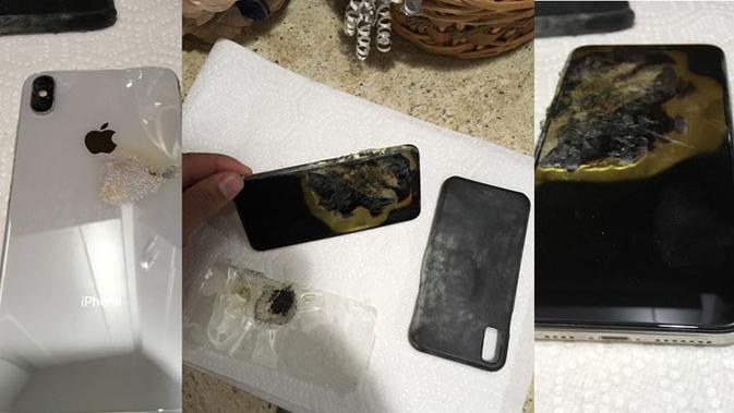 iPhone XS Max tiba-tiba terbakar di saku celana penggunanya. (Doc: Josh Hillard/ iDrop News)