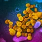 Gambar menggunakan mikroskop elektron yang tak bertanggal pada Februari 2020 menunjukkan virus corona SARS-CoV-2 (kuning) muncul dari permukaan sel (biru/pink) yang dikultur di laboratorium.  Sampel virus dan sel diambil dari seorang pasien yang terinfeksi COVID-19. (NIAID-RML via AP)
