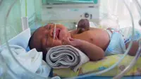 Siti Rahmah, bayi dengan organ jantung di luar tubuh, saat di dalam kotak inkubator di RS Ibnu Sina, Pekanbaru, Riau. (Antara)