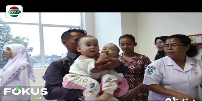Bayi Kembar Siam di Medan Segera Jalani Operasi Pemisahan