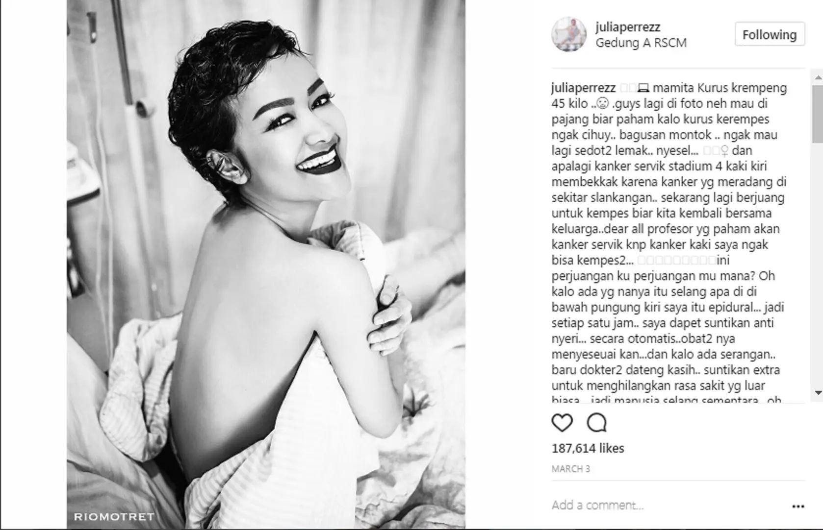Julia Perez ingin menunjukkan pada orang lain agar bisa tetap tersenyum menghadapi cobaan. (Instagram @juliaperrezz)
