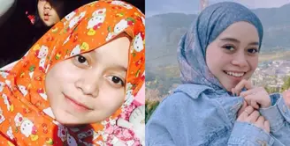 Lesti Kejora baru saja mengunggah foto lawas bersama sang kakak. Dalam foto tersebut, Lesti pun memerlihatkan wajahnya saat masih kecil. Selain itu, ibu satu anak ini kerap membagikan potret dirinya tetep glowing tanpa makeup, penasaran? Simak ulasanya.