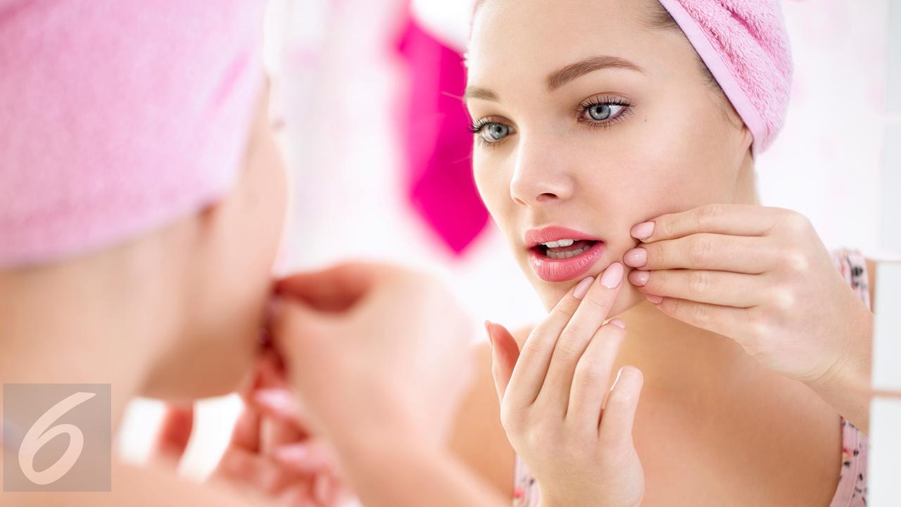 20160905 Jerawat Wajah