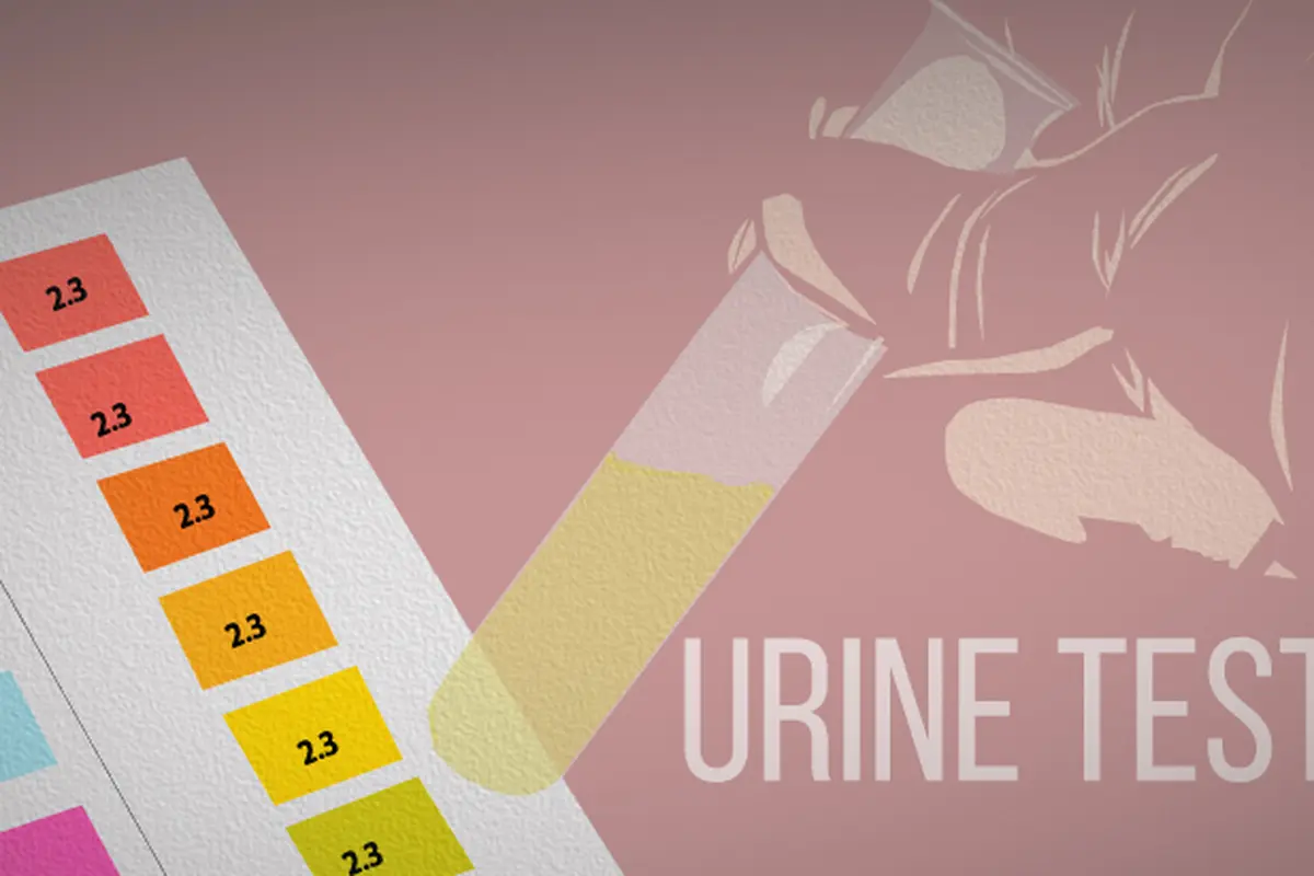 Ilustrasi Tes Urine 