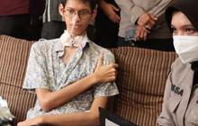 Kondisi Terkini Sultan Rifat Mahasiswa Terjerat Kabel Optik, Berat Badan Mulai Naik Usai Turun 22 Kilogram