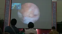 Menyaksikan Langsung Operasi Lutut 