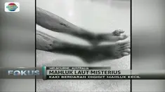 Kaki seorang remaja lelaki ini tampak mengerikan setelah digigit oleh makhluk-makhluk kecil di laut. Makhluk apa itu?