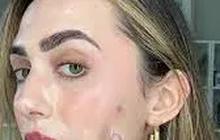 Jerawat Bukan Lagi Masalah Dengan Sandwich Makeup Method