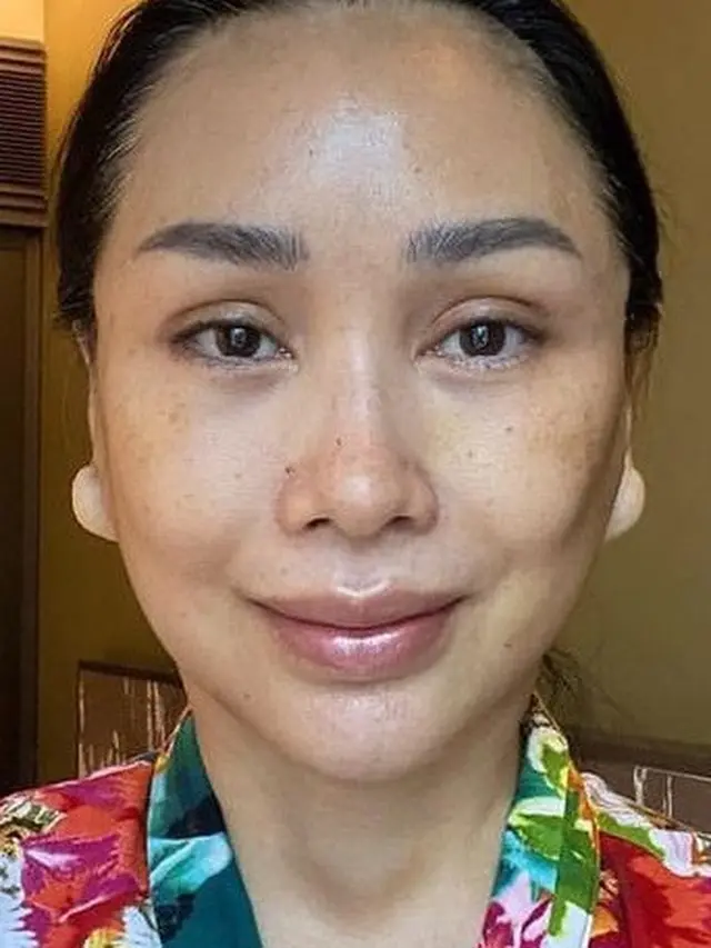 6 Potret Transformasi Titi DJ Usai Operasi Anti Aging, Makin Awet Muda