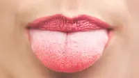 Jangan diabaikan, ini ciri-ciri kanker lidah yang sering disepelekan. (Sumber Foto: Healthline)