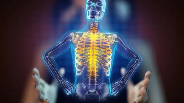 Asupan Pencegah Osteoporosis Selain Susu