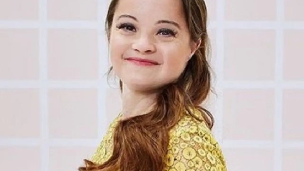 Katie Meade, Model Down Syndrome Pertama untuk Produk Kecantikan