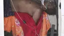 Pasien COVID-19 terbaring di dalam kendaraan untuk dirawat di rumah sakit pemerintah khusus COVID-19 di Ahmedabad, 22 April 2021. Otoritas India bergegas membawa tangki oksigen ke rumah sakit tempat pasien COVID-19 tercekik di tengah gelombang virus corona terburuk di dunia. (AP Photo/ Ajit Solanki)