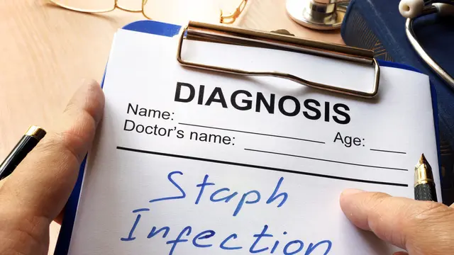 Infeksi staph (iStock)