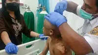 Bocah Kakak Beradik di Sidikalang Jadi Korban Penyiksaan Sadis