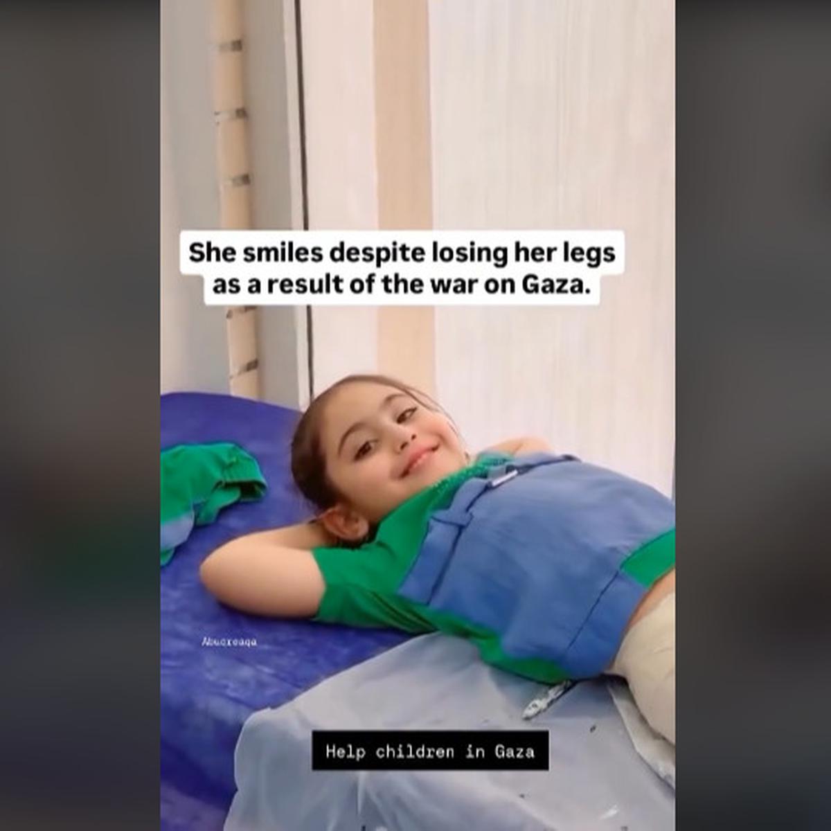 Sosok Luar Biasa Bocah Perempuan Palestina Masih Bisa Tersenyum Walau Kedua Kakinya Hilang Akibat Bom Israel