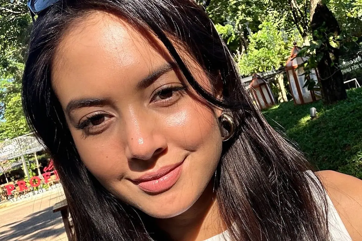 Kisah Aurelie Moeremans Pernah Disebut Dekil hingga Disarankan Suntik Putih