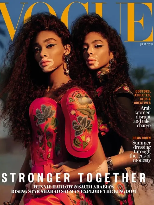 Winnie Harlow dan Shahad Salman