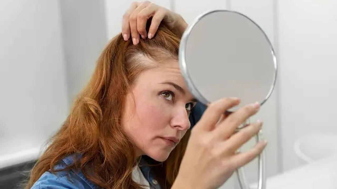 Benarkah Merokok Bisa Menyebabkan Rambut Rontok? Ini Fakta yang Perlu Diketahui