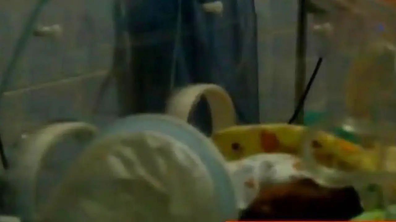 Segmen 4: Persalinan Bayi Kembar Siam hingga Pundi Amal SCTV