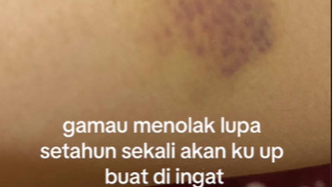 Cerita MUA Tak Dilunasi Riasannya, Ditagih Malah Dipukul sama Ibunya Pengantin 'Saya Lagi Hamil Muda'