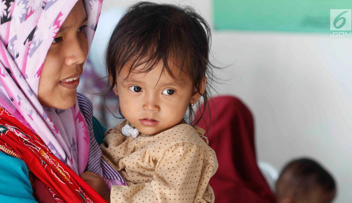 FOTO Melihat Kondisi Anak Anak Kurang  Gizi  di Pandeglang 