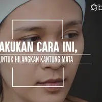 Kantung mata memang bikin penampilan jadi nggak banget. (Foto: Adrian Putra/Bintang.com, Digital Imaging: Muhammad Iqbal Nurfajri/Bintang.com)