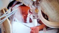 Hendak Dikremasi, Bayi Baru Lahir Hidup Kembali