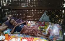 Idap Hidrosefalus Sejak Usia Empat Bulan, Gadis di Lebak Ini Butuh Bantuan untuk Berobat