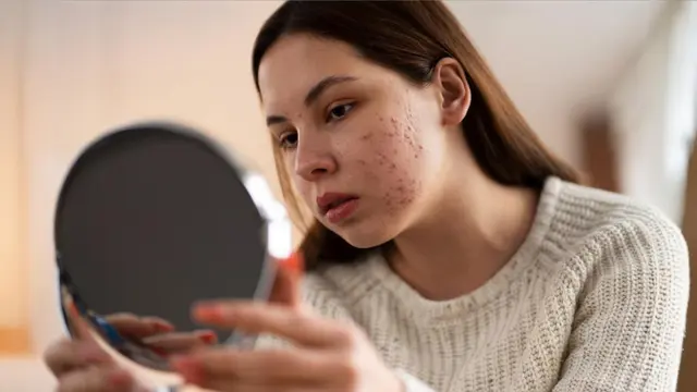 Air Keran Bikin Jerawat? Ini Dia 6 Masalah Kulit yang Bisa Muncul Akibat Air yang Tidak Cocok! (Foto: Freepik/freepik)